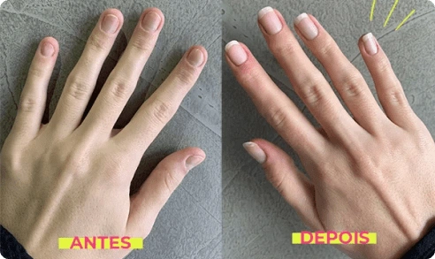 antes-e-depois-4-min