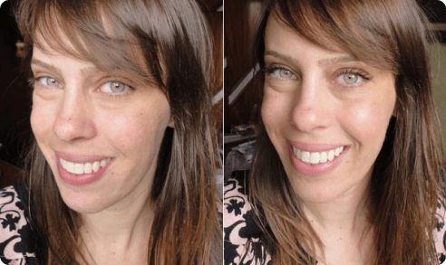 antes-e-depois-5-min